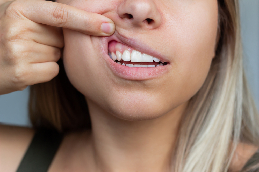 Gum,Health.,Close up,Of,A,Young,Woman,Showing,Healthy,Gums.