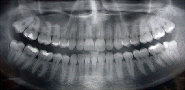 panoramic x-ray image