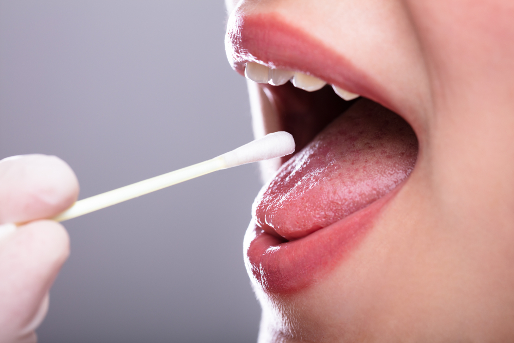 oral cancer screening