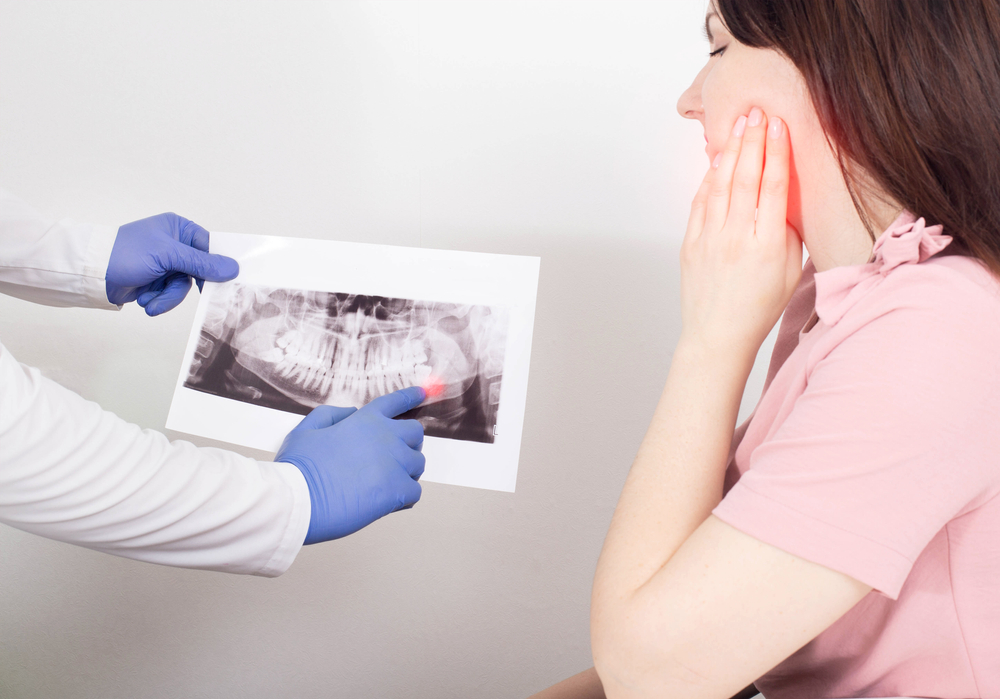 wisdom tooth x-ray