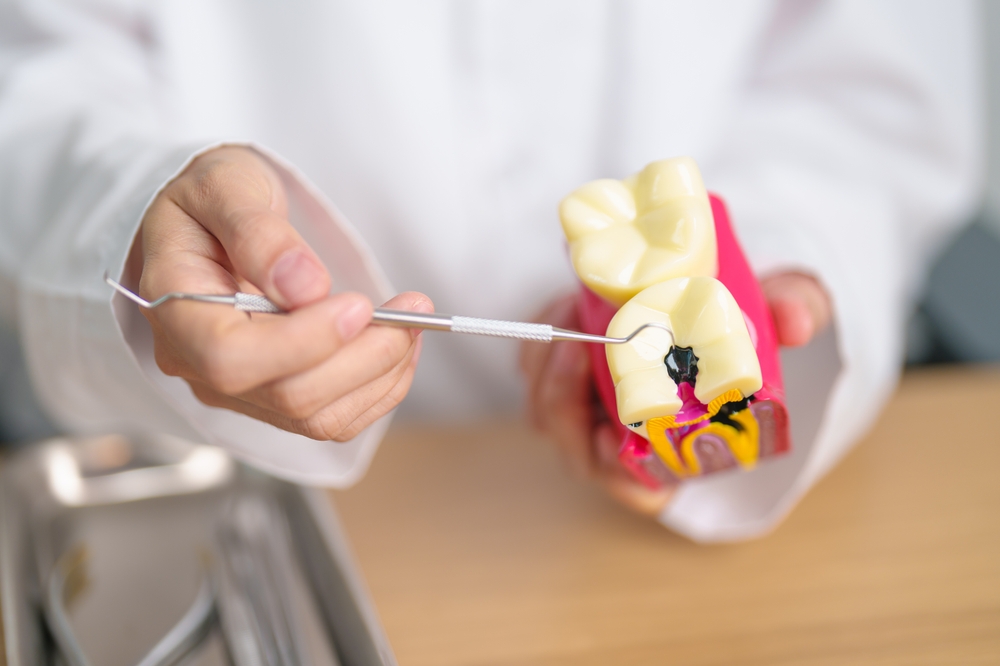 Dentist,With,Tooth,Anatomy,Model.,Oral,Teeth,Decay,And,Disease,